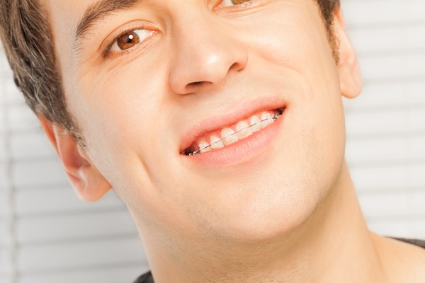 How Clear Braces Can Give You Straighter Teeth