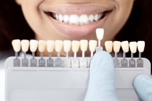 How A Family Dentist Uses Dental Bonding