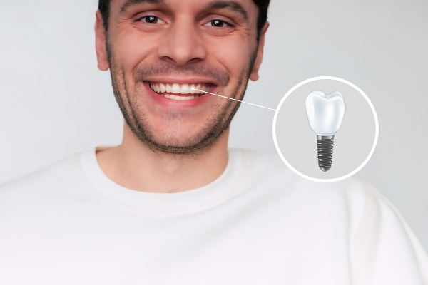 Dental Implants Vs  Other Tooth Replacement Options